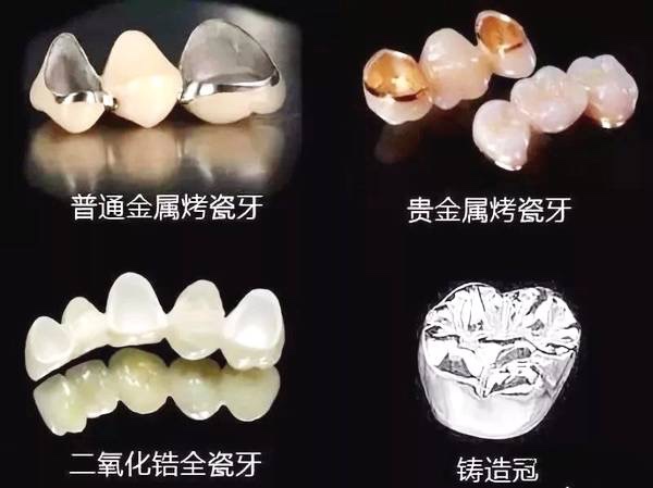 常德美奧口腔鉅惠看牙,韓國登騰種植牙3980元起,自鎖托槽矯正享5折優(yōu)惠！
