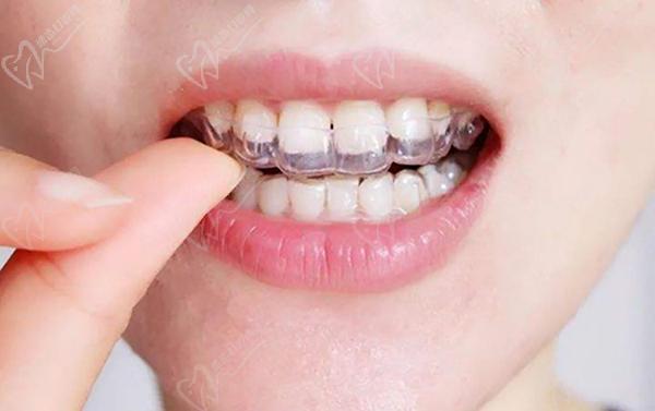 網(wǎng)購牙套戴出問題了怎么辦？
