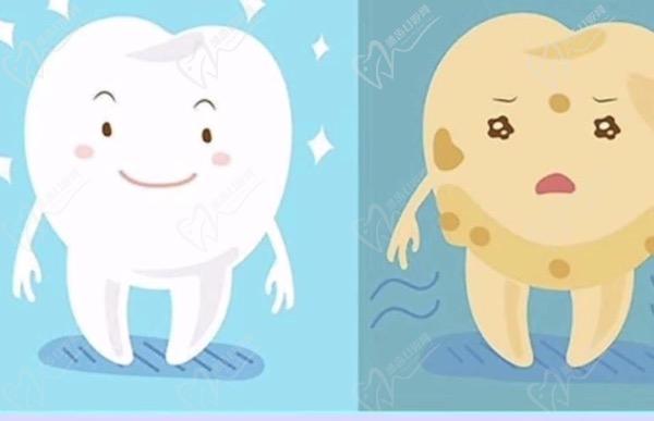 氟斑牙是什么原因造成的？