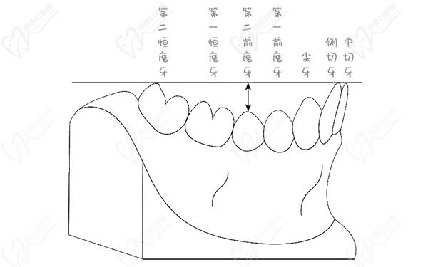 正畸spee曲線(xiàn)的測(cè)量圖