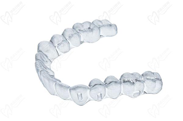 透明牙齒矯正器大概要花費(fèi)多少錢(qián)