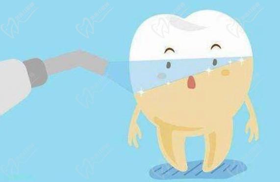 viva冷光美白是國(guó)產(chǎn)的嗎？