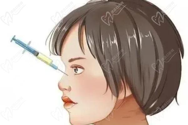 玻尿酸填充鼻子哪個牌子比較好？