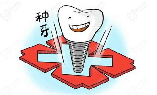 砸金蛋禮：消費(fèi)每滿一萬(wàn)砸蛋一次，各種精美禮品贈(zèng)送，驚喜連連！
