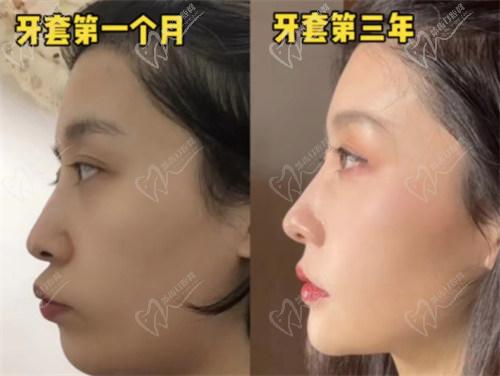 四、如何預(yù)約拜博口腔醫(yī)院牙齒矯正？
