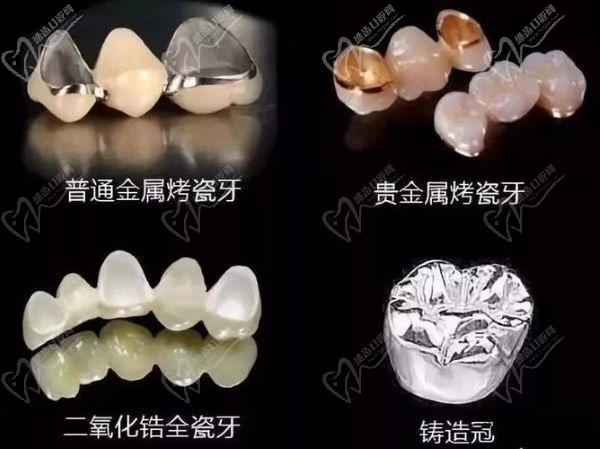 臺山壹心維美口腔醫(yī)院口腔修復(fù)醫(yī)生