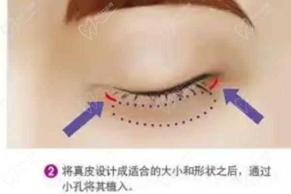 周美蘭的雙眼皮非常新圖片