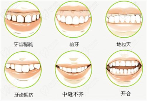 2025年國內(nèi)牙齒矯正價格因矯正方式、醫(yī)院級別和地區(qū)差異而有所不同
