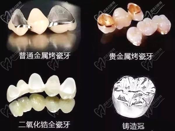 常德美奧口腔鉅惠看牙,韓國登騰種植牙3980元起,自鎖托槽矯正享5折優(yōu)惠！