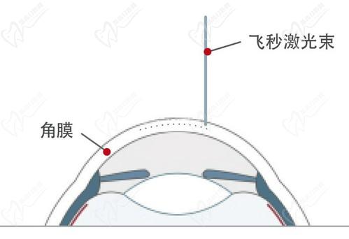 王曉瑛醫(yī)生在哪里出診？上海普瑞、上海和平等眼科醫(yī)院可預(yù)約